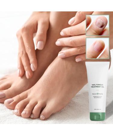  Raypontia Nail Cream - 20ml Intensive Strengthening Gel for Nails Moisturizing Care for Dry and Cracked Nails Men and Women Nighttime Use Shower Travel Home Sports - Buy Online on GoSupps.com