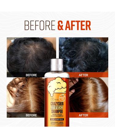 Crazy Skin Beer Yeast Hair Shampoo 300g - Nourishing Formula for Strong, Healthy Hair - Buy Online on GoSupps.com