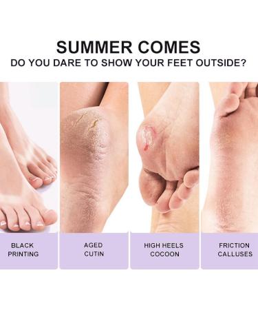 3Pairs Foot Peel Mask Foot Care Exfoliating Foot Peeling Mask for Dead Skin Exfoliating Socks Foot Mask Moisturizing Feet Peeling Mask for Dry Skin Skincare Socks for Women Foot Spa Peeling Foot Mask - Buy Online on GoSupps.com