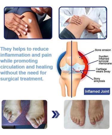 Creams for joints 113 g natural joint lotion soothing lotion for shoulder knee neck women men - Buy Online on GoSupps.com