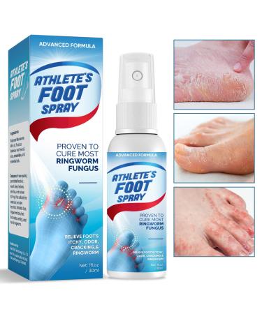 Athletes Foot Treatment Athletes Foot Spray Foot Spray Foot Treatment Easy to Use 30ml Blue