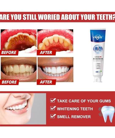SP-4 Probiotic Rapid Whitening Toothpaste - Nanb Whitening Toothpaste 100G (3PCS) - Buy Internationally | Best Whitening & Dental Care - Buy Online on GoSupps.com