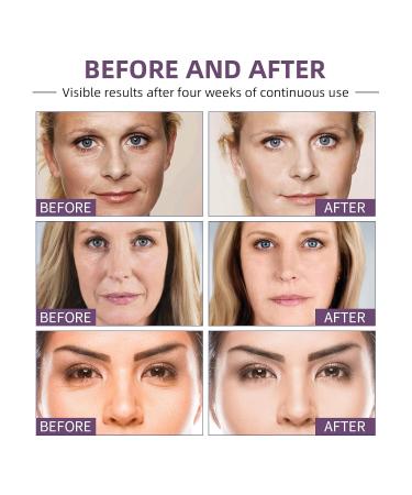 Bakuchiol Serum for Face Anti Wrinkle Hydrating Serum with Bakuchiol Oil Tremella Extract Hyaluronic Acid Reduces Fine Lines Plumps Skin 1 Fl Oz (3 Pack Fresh) - Buy Online on GoSupps.com