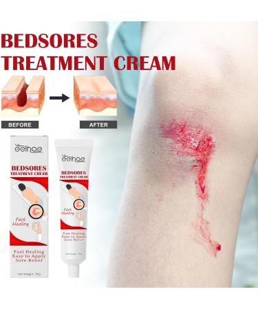 Pressure Soress Relief Cream 20g Bedsore Ointment Bed Soress Care Cream Fast Healing Soress Relief Healing Cream For Chafed Skin Hard-to-Heal Skin Soress Soothing Relief - Buy Online on GoSupps.com