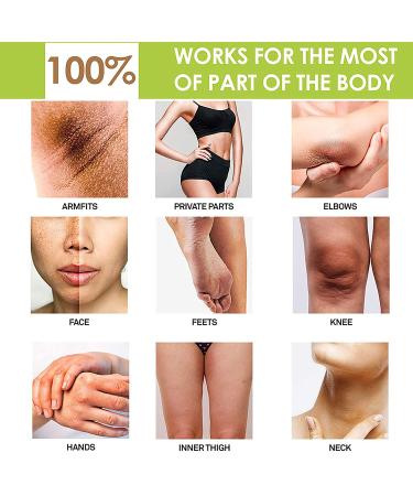 Skin Brightening Serum with Kojic Acid - Dark Spot Corrector for Face & Body - Fade Hyperpigmentation & Melasma - 1 oz (Pack of 2) - Buy Online on GoSupps.com