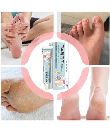 Foot Cream Heel Cream 20g Fast Absorption With Plantation Extracts Itch Relief Skin Nail Care For Athletes Travel Pedicure Preparation Night Treatment - Buy Online on GoSupps.com