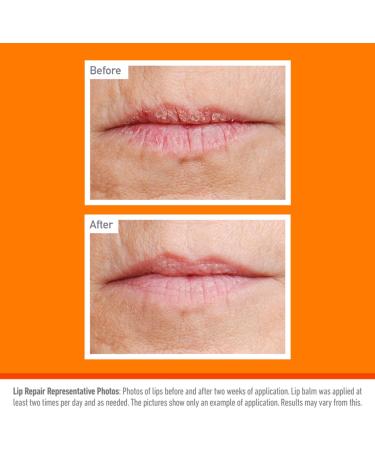 O'Keeffe's Lip Repair Cherry 4.2g For extremely dry cracked lips | With Cherry Oil and Vitamin E provides all-day hydration - Buy Online on GoSupps.com