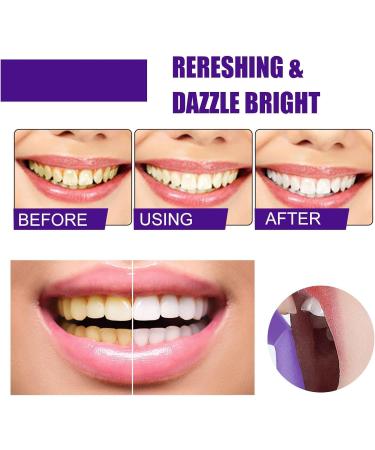 Purple Toothpaste for Teeth Whitening: Best Color-Correcting Foam Toothpaste for Stain Removal - Sensitive Teeth Brightening & Non-Peroxide Whitening - for Adults1.5 fl oz 1.5 Fl Oz (Pack of 1) - Buy Online on GoSupps.com