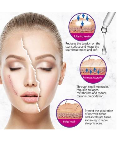 AICHUN BEAUTY Lavender Extract Scar Repair Essence | Anti-Scar Essential Oil for Smooth Skin | 30ml - Buy Online on GoSupps.com