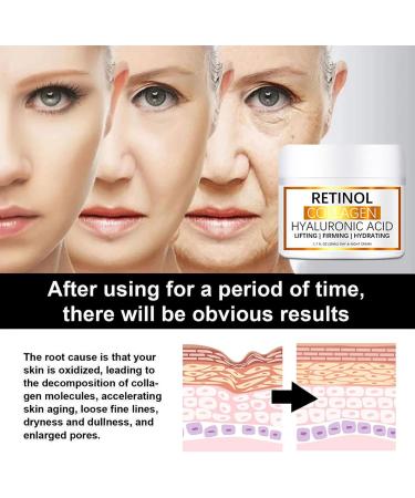 Retinol Face Cream with Hyaluronic Acid & Vitamin E - Collagen Cream - Anti Wrinkle Face Cream - Skin Lightening Cream - Dark Spot Remover - Anti Aging Face Cream - Night Cream for Women - Buy Online on GoSupps.com