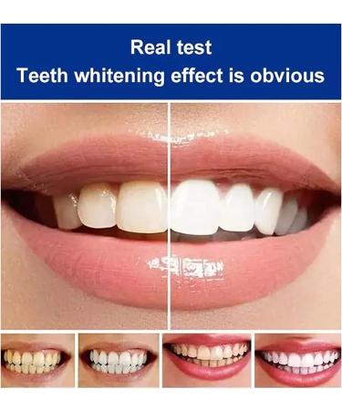 Sp-6 Ultra Whitening Toothpaste Ms Drwikey Toothpaste Sp-6 Pasta Dental Sp-6 Sp6 Ultra Whitening Toothpaste Oralhoe Toothpaste Sp 6 Whitening Toothpaste Removes Years of Stains (2PCS-RED) - Buy Online on GoSupps.com