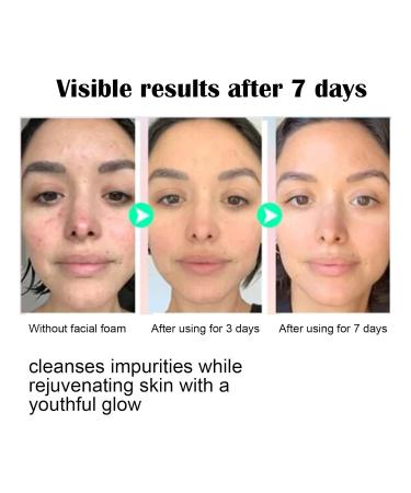 Facial Cleanser - Deep Pore Cleansing Acne Mark Fading Moisturizing & Firming Leaves Skin Youthful Glowing(3PCS) - Buy Online on GoSupps.com