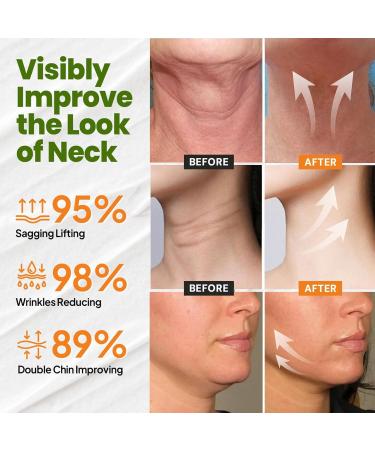 AEEHFENG New Ah-8 Firming Neck Cream Advanced Neck Firming and Tightening Cream Neck Firming Cream Tightening Lifting Sagging Skin Natural Ingredients for All Skin Types (2 Pack) - Buy Online on GoSupps.com