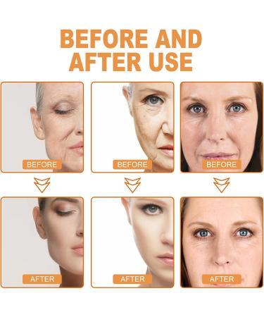 Cynamus Anti-Ageing Moisturising Cream 70 g Aging Face Cream - Neck - Anti-Wrinkle Day & Night Cream Nourishing Day Cream for Men and Women Against Wrinkles with Anti-Ageing Effect - Buy Online on GoSupps.com