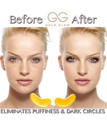 Gold Glow Under Eye Patches - 24K Gold Masks for Dark Circles & Puffiness with Collagen, Hyaluronic Acid, Vitamin C - 30-Pairs - Buy Online on GoSupps.com