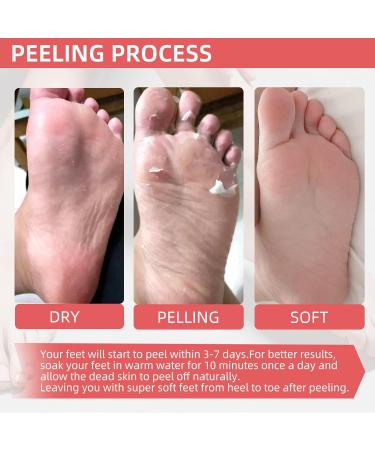 Soothing Peach Foot Peel Mask - 2 Pack for Dry, Cracked Feet - Exfoliating and Softening Formula for Baby Soft Feet - Callus Remover - Includes 2 Pairs - Buy Online on GoSupps.com