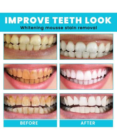 Teeth Whitening Toothpaste Mousse 50ml - Foam for Bright White Teeth & Stain Removal | Color Correction for Smoking & Yellow Teeth - Buy Online on GoSupps.com