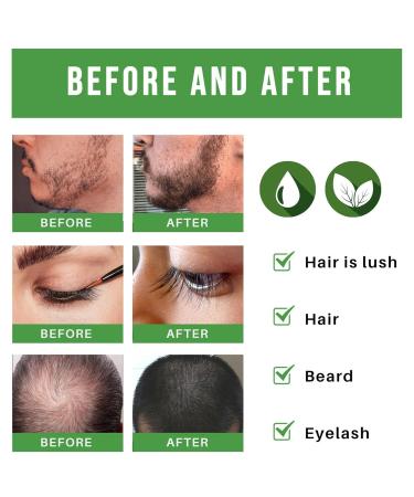 2stk Rosemary Oil for Hair Growth - Natural Hair Growth Oil for Men & Women Nourishes Scalp & Reduces Hair Loss - 60ml - Buy Online on GoSupps.com