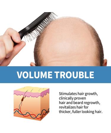 Hair Density Essential Oil Fast Hair Growth Serum Hair Regrowth Essence Nourish Scalp Hair Care Essential Oil Reduce Hair Loss - Buy Online on GoSupps.com