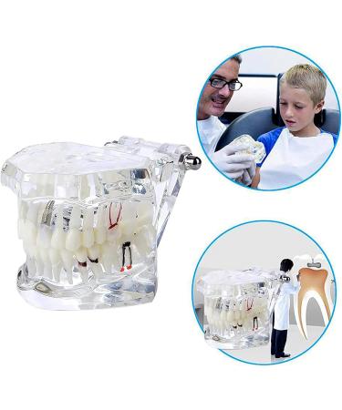 Buy DYTAH Transparent Teeth Model - Removable Pathological Tooth for Dental Training & Examination | International Shipping - Buy Online on GoSupps.com