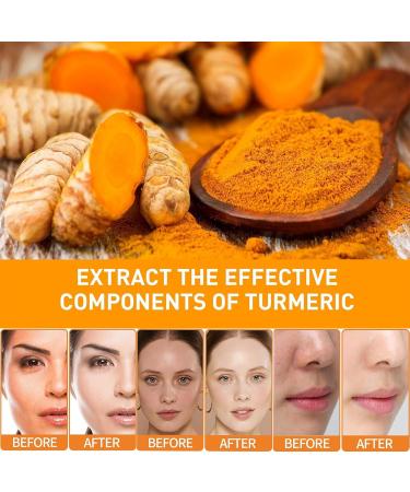 Kojic Acid Turmeric Oil Dark Spot Remover for Face Kojic Acid Serum Turmeric Face Cream Turmeric Oil For Dark Spots Dark Spot Correcting Serum For Women (1) - Buy Online on GoSupps.com