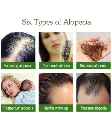 Hair Growth Serum for Men & Women - Anti-Hair Loss Accelerates Growth Fuller & Thicker Hair - Buy Online on GoSupps.com