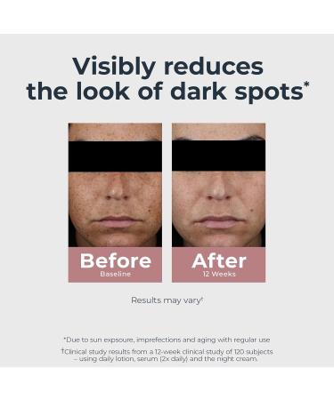 Eucerin Radiant Tone Daily Face Lotion with SPF 30 Dark Spot Corrector with Thiamidol Face Moisturizer Helps Visibly Reduce the Look of Persistent Dark Spots All Skin Types 1.7 Fl Oz Bottle - Buy Online on GoSupps.com