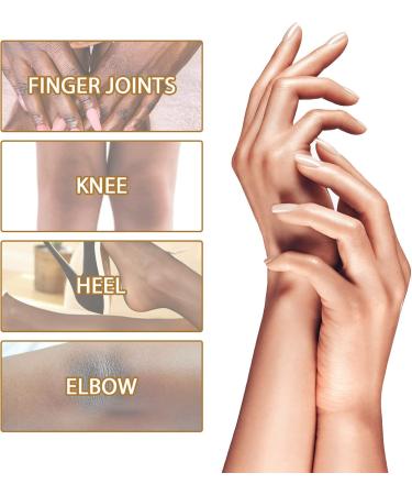 NigriCare Acanthosis Therapy Drops Nigricans for Neck Hands Elbows Dark Spots Pack of 2 - Buy Online on GoSupps.com