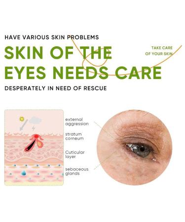Aloe Vera Eye Cream for Wrinkles & Dark Circles | 98% Aloe Extract | Anti-Aging Daily Care - Buy Online on GoSupps.com