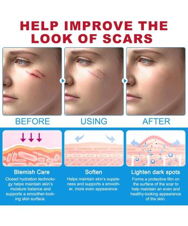 Scars Cream - 20g Light Butter Non Sticky Body Cream Butter Stick For Scars Burn | For Hands Legs Knees Neck Burn Buttons Women Face Body - Buy Online on GoSupps.com