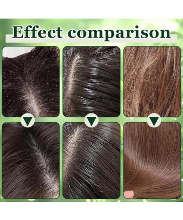 Shampoing Solide Triangle Vert Savon Vert aux Plantes Purifiantes Nettoyant pour Cheveux Gras et Pousse Capillaire Shampoing Solide Bio conomique et cologique - Buy Online on GoSupps.com