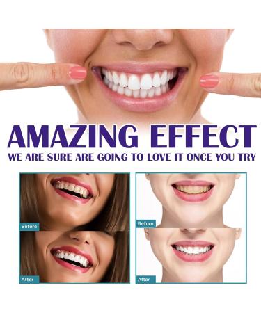 KLYso Advanced Teeth Whitening Toothpaste for A Brighter Healthier Smile - Oral Cleaner Tartar Remover Gingivitis Treatment Fresh Breath & Sensitive Teeth Relief(1PCS) - Buy Online on GoSupps.com