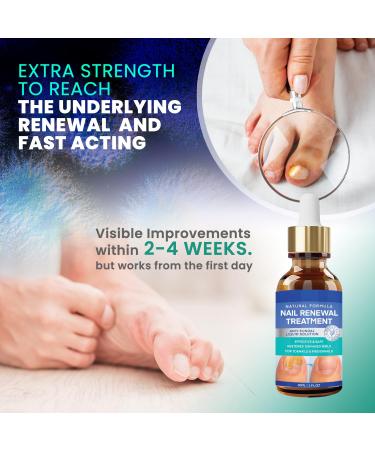 Extra Strength Toenail Treatment - Nail Renewal Repair Solution for Thick Broken & Discolored Nails (1oz) | International Shipping - Buy Online on GoSupps.com