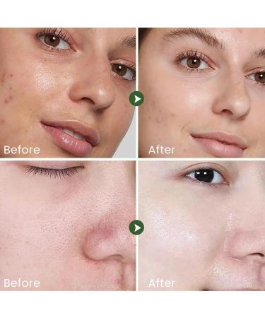 Brightening Face Toner | Reduce Fine Lines Moisturizing Skin Toning Essence | Brighten Skin Essence Refreshing and Hydrating Skincare Products - Buy Online on GoSupps.com