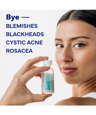EMUAID Overnight Acne Treatment Gentle Fast-Acting Solution with Salicylic Acid for Adults and Teens Clears Stubborn Pimples Cystic Acne Blackheads Rosacea and Hormonal Breakouts 1oz - Buy Online on GoSupps.com