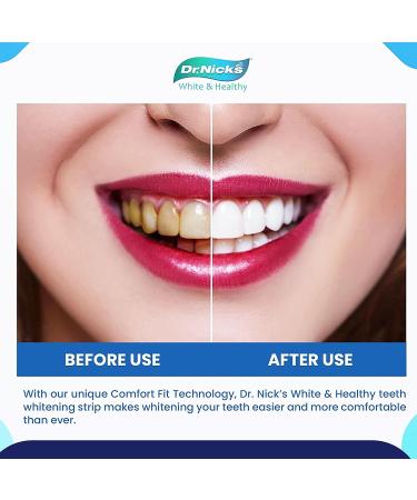 Dr. Nick's White & Healthy Professional Teeth Whitening Strips - 20 Treatments, Dentist Formulated for Sensitive Teeth - Buy Online on GoSupps.com