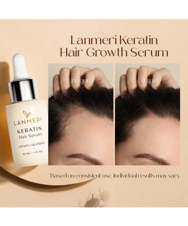 Lanmeri Hair Growth Serum with Keratin Amino Complex - Anti Frizz Control, Repair, and Thickening Treatment for Dry, Damaged Hair - Hair Loss Prevention for Men and Women - Buy Online on GoSupps.com