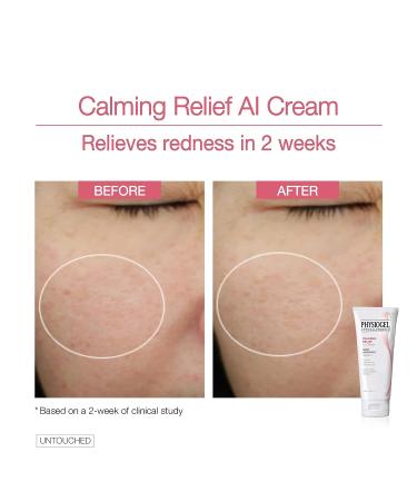 Physiogel Calming Relief A.I. Face Cream - Soothing Eczema Cream for Sensitive Skin - Buy Online on GoSupps.com