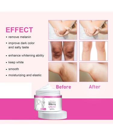  KOAHDE Skin lightening cream body lightening lotion body lightening cream anti-aging for women and men underarm whitening cream - Buy Online on GoSupps.com