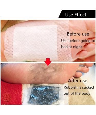 100 Piece Deep Cleansing Foot Pads | Bamboo Vinegar & Ginger Foot Patches - Buy Online on GoSupps.com