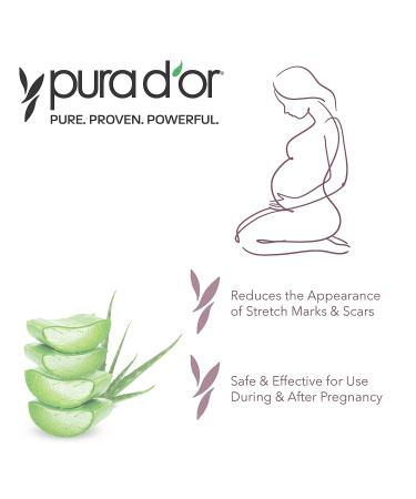 Buy PURA D OR BetterBelly Organic Aloe Vera Gel - Scar Healing & Stretch Marks Solution - Essential for C-Section & Postpartum Care - 16oz Body Skin Care - Buy Online on GoSupps.com
