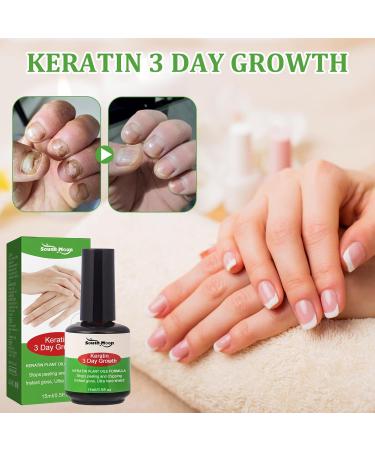 Nail Strengthener for Nail Growth Treatment Keratin 3 Day Growth Nail Treatment & Strengthener Nail Strengthener for Damaged Nails Nail Hardener for Weak Nails - Buy Online on GoSupps.com