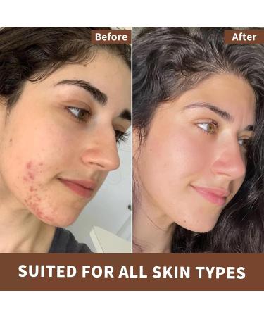 Flower Say USDA Organic Tea Tree Oil for Skin Natural Australian Tea Tree Essential Oil for Toenail Undiluted 100% Pure Tree Tea Oil for Scalp Diffuser & Aromatherapy 10ml (0.34 Fl Oz) Tea Tree 0.34 Fl Oz (Pack of 1) - Buy Online on GoSupps.com