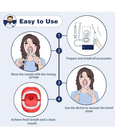 Tonsil Stone Remover | Clean & Fight Bad Breath | Oral Irrigator Tool for Stone Removal - International Shipping - Buy Online on GoSupps.com
