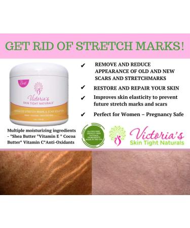 Best Stretch Marks Cream - Prevent & Reduce Pregnancy Marks | Highly Concentrated Formula + Free $29 Scar Reducing Guide - International Shipping Available - Buy Online on GoSupps.com