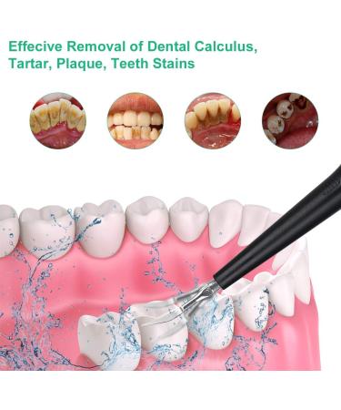 Electric Dental Calculus Remover - Plaque & Tartar Stain Removal Tool with LED Light | Sonic Tooth Cleaner Scraper Kit - USB Rechargeable | 3 Adjustable Modes - Black - Buy Online on GoSupps.com