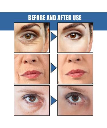  Generisch 5-Second Firming Lifting Anti-Aging Cream Immediate Effect Anti-Puffiness and Eye Lift Firming Moisturizing Care for Face and Eyes Firming Face and Eyes 1 - Buy Online on GoSupps.com