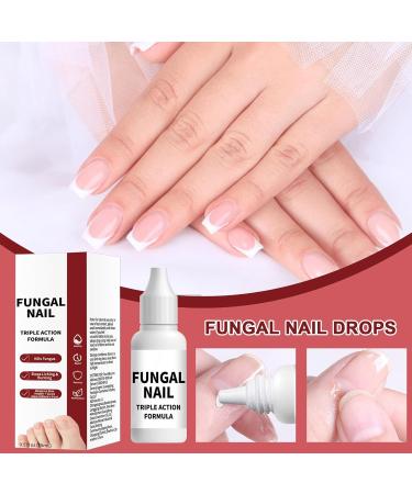 Whrcy Fingernail repair drops Damaged Hands Feet Nails Repair Solution 15ml Deep Hydration Booster with Precise Dropper for All Seasons Teens Adults Women - Buy Online on GoSupps.com