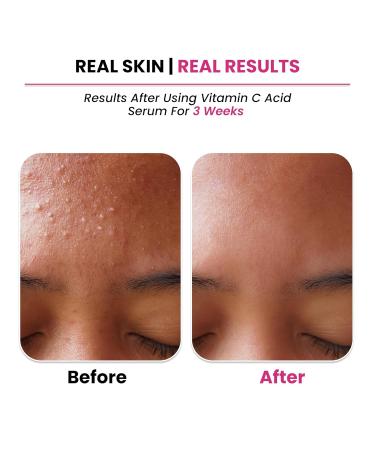 10% Vitamin C Serum For Face With Hyaluronic Acid | Gives Instant Brightening Effect & Glowing Skin | For Men & Women | All Skin Types | Non-Sticky Vegan Fragrance & Cruelty-Free | 30ml - Buy Online on GoSupps.com