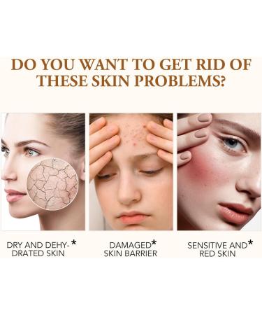 Korean Skincare Snail Cream - Hydrating Face Moisturiser for Women - Repair & Soothe Dry Skin with Snail Mucin Serum - Deep Moisture and Anti-Aging Effects - All in One Face Cream 3.53 oz/100g - Buy Online on GoSupps.com